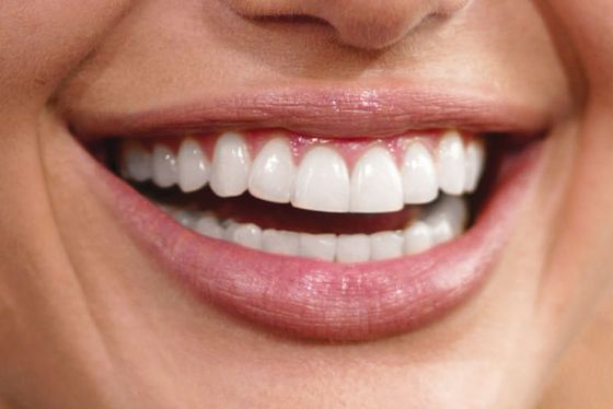Why Is America Obsessed With Perfect Teeth? -- Science of Us