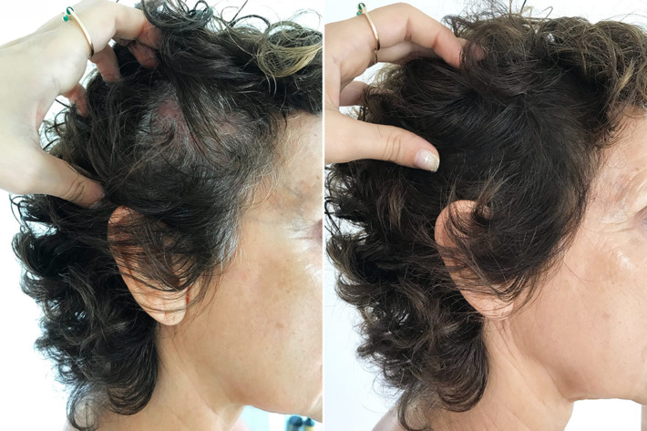 Gray roots and colored dark roots, shown in the Strategist's review of hair powder Color Wow.